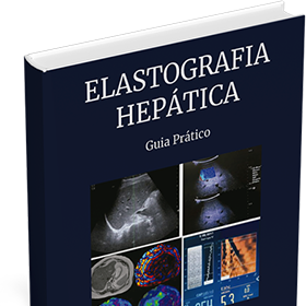 E-book Elastografia Hepática - Guia Prático